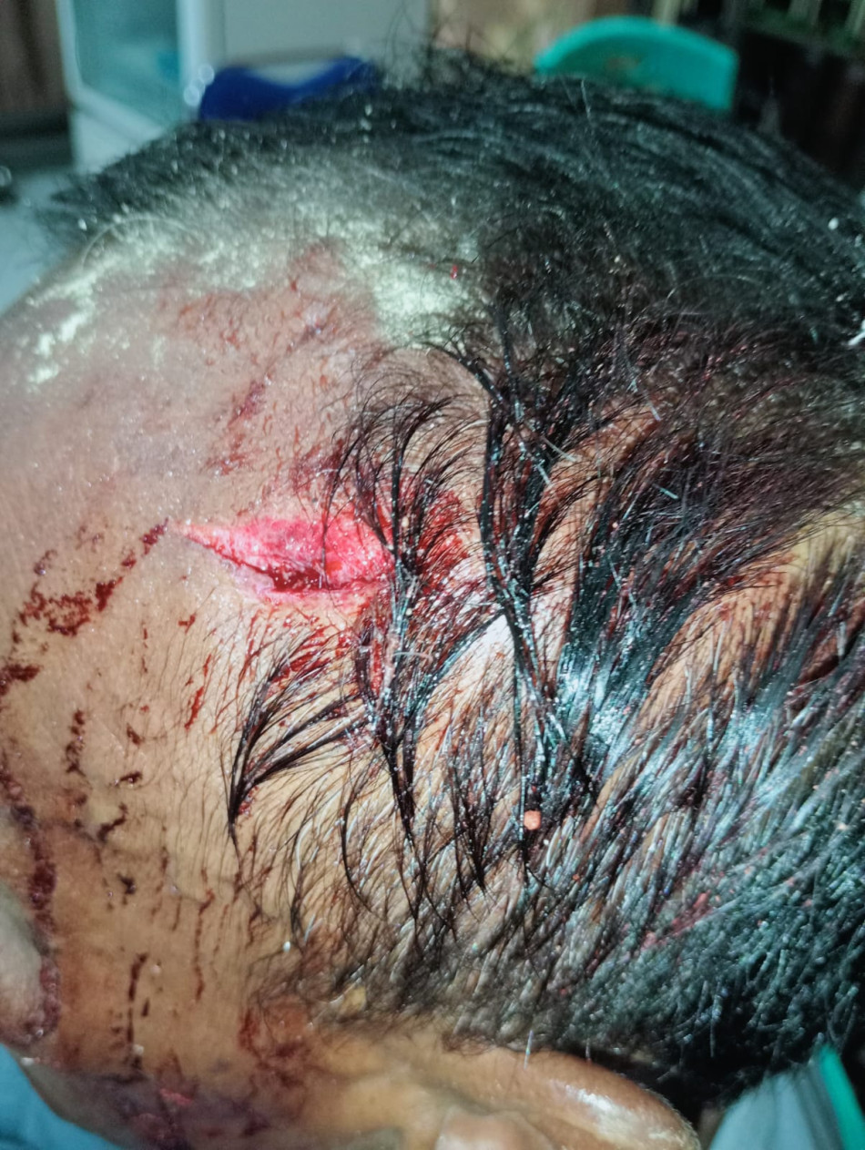 Alami Penganiayaan, Korban Desak Aparat Hukum Segera Tangkap dan Proses Pelaku